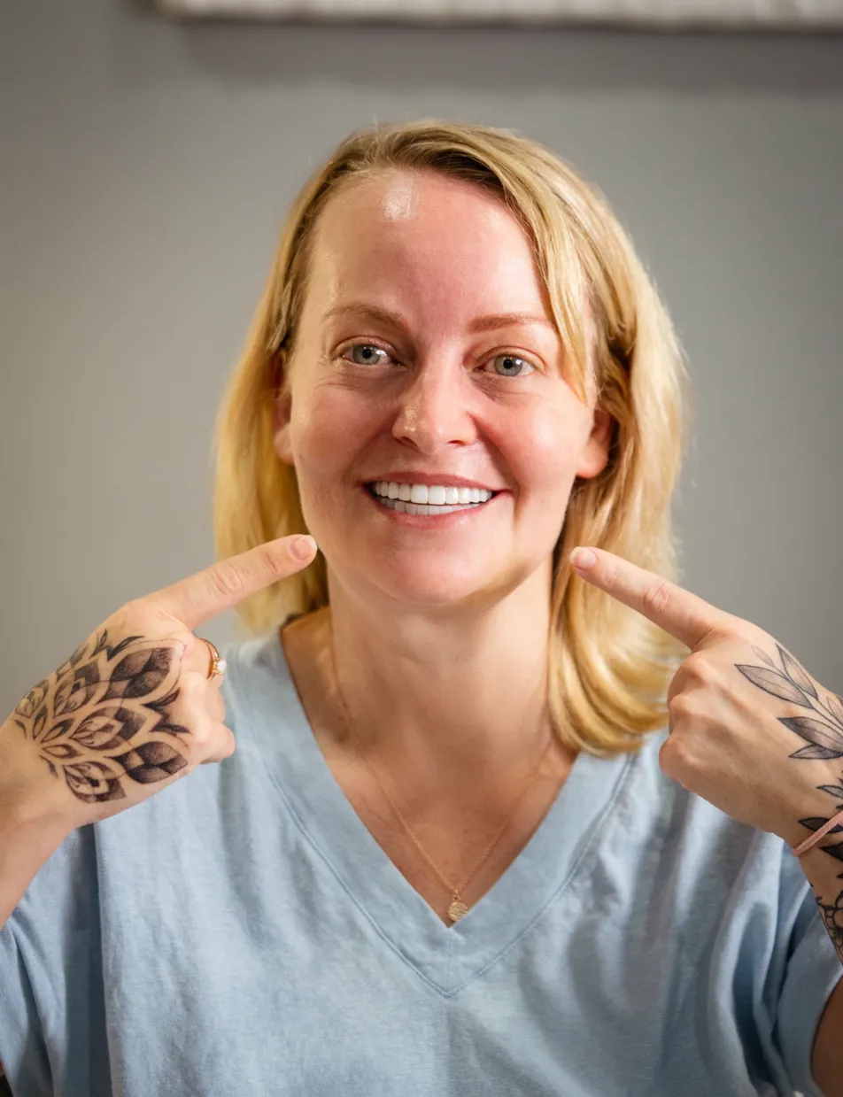 Porcelain veneers patient at Greenfield Dental Hanoi