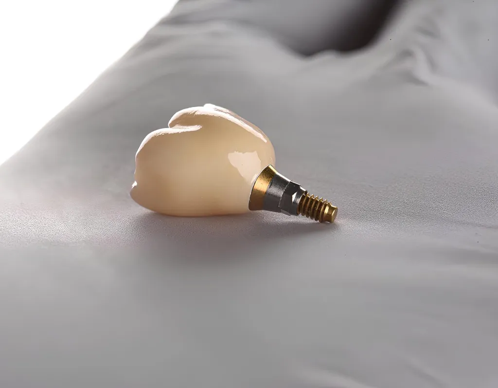 Dental Implants at Greenfield Dental Hanoi