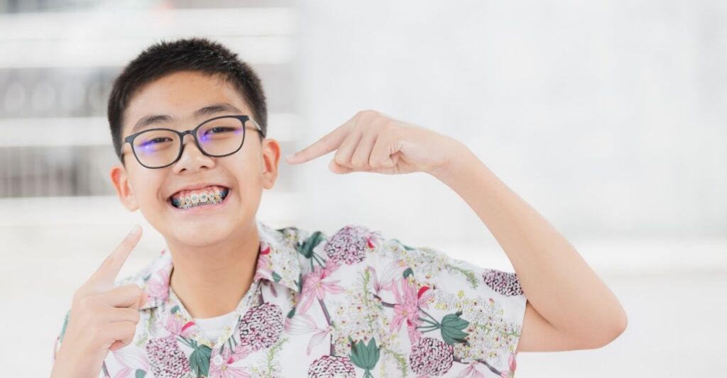 Các lựa chọn niềng răng phổ biến đều có ưu điểm riêng, phù hợp với nhu cầu và